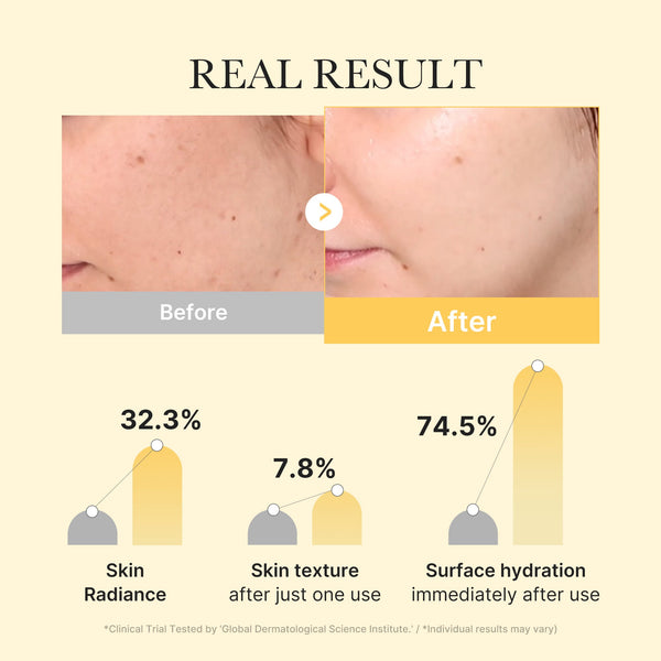 24 Karat Gold Anti-Aging